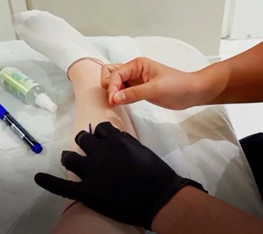 Needling Therapy